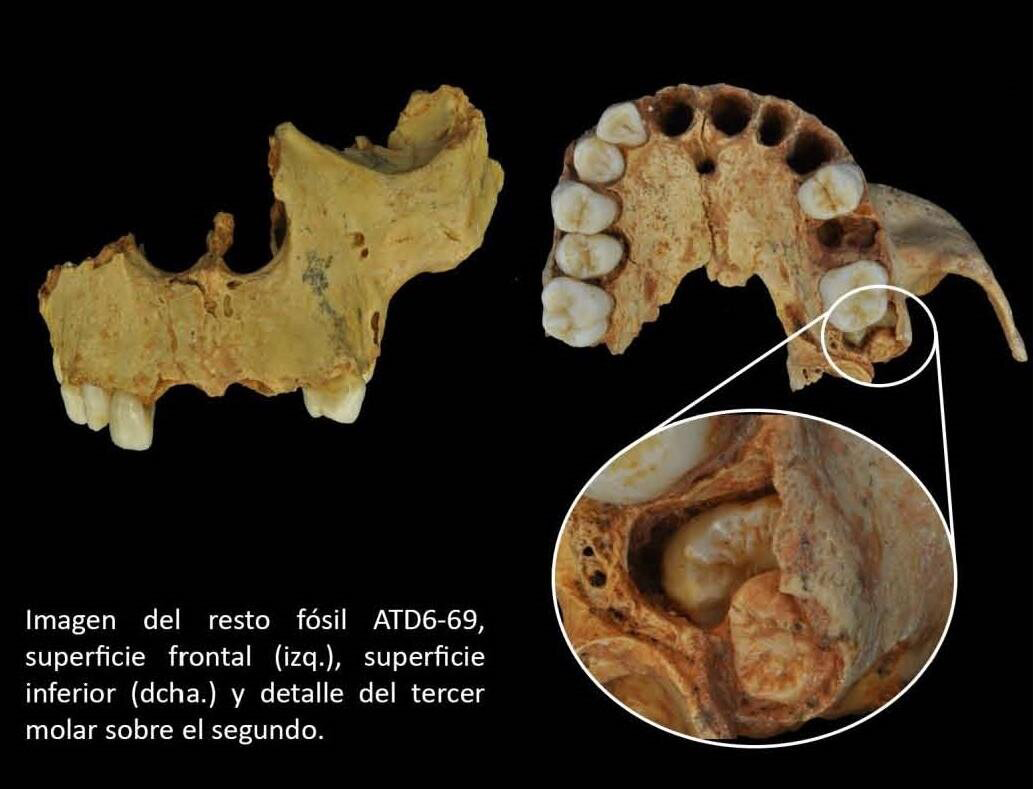 Analysis of the maxilla ATD6-69, 