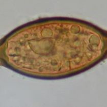 Helminth infections common in Medieval Europe