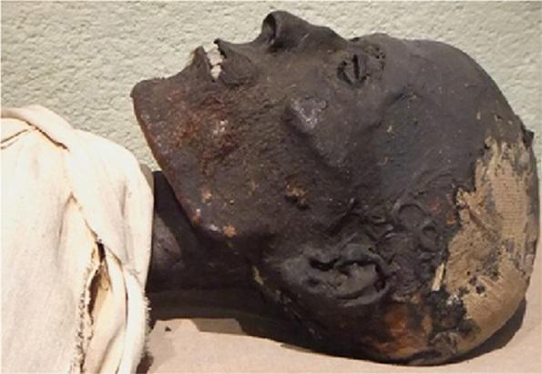 Researchers analyzed embalming material from the neck of this Ancient Egyptian mummy, which was acquired by a French museum in 1837. Credit : Frédérique Vincent, ethnographic conservator