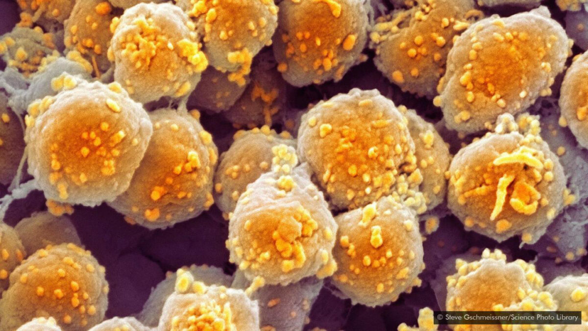 New research on predicting the earth's future climate: Using gravitational-wave science, a group of international scientists, including Australian OzGrav astrophysicist Ilya Mandel, studied ancient marine fossils as a predictor of climate change. Credit: Steve Gschmeissner/Science Photo Library