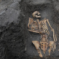 Inequality in medieval Cambridge in the bones of its residents