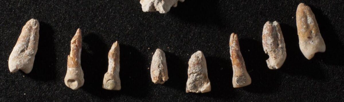 Teeth with dental inlays from a nonroyal elite Mayan tomb. Credit : Kenichiro Tsukamoto