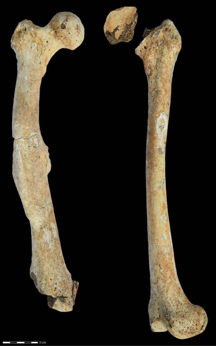 Right and left femoral bones of the male individual from the North Caucasus. The bones exhibit pathological changes examined in the study. © Katharina Fuchs, Institut für Klinische Molekularbiologie