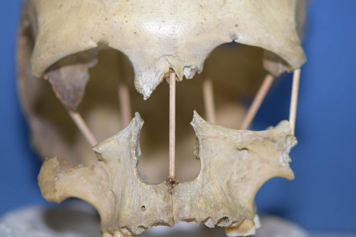The skull of Peştera Muierii 1, which entire genome is now successfully sequenced. Credit : Mattias Jakobsson