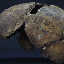 Plague case 5000 years ago in Latvia