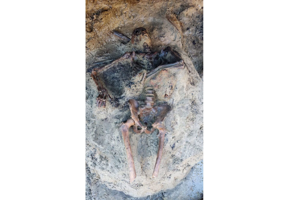 The man was aged between 40 and 45. Skull and bones are heavily blackened and his body shows indications of numerous heat-induced fractions. Credit : Parco Archeologico di Ercolano.