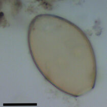 Prehistoric faeces reveal parasites from feasting at Stonehenge