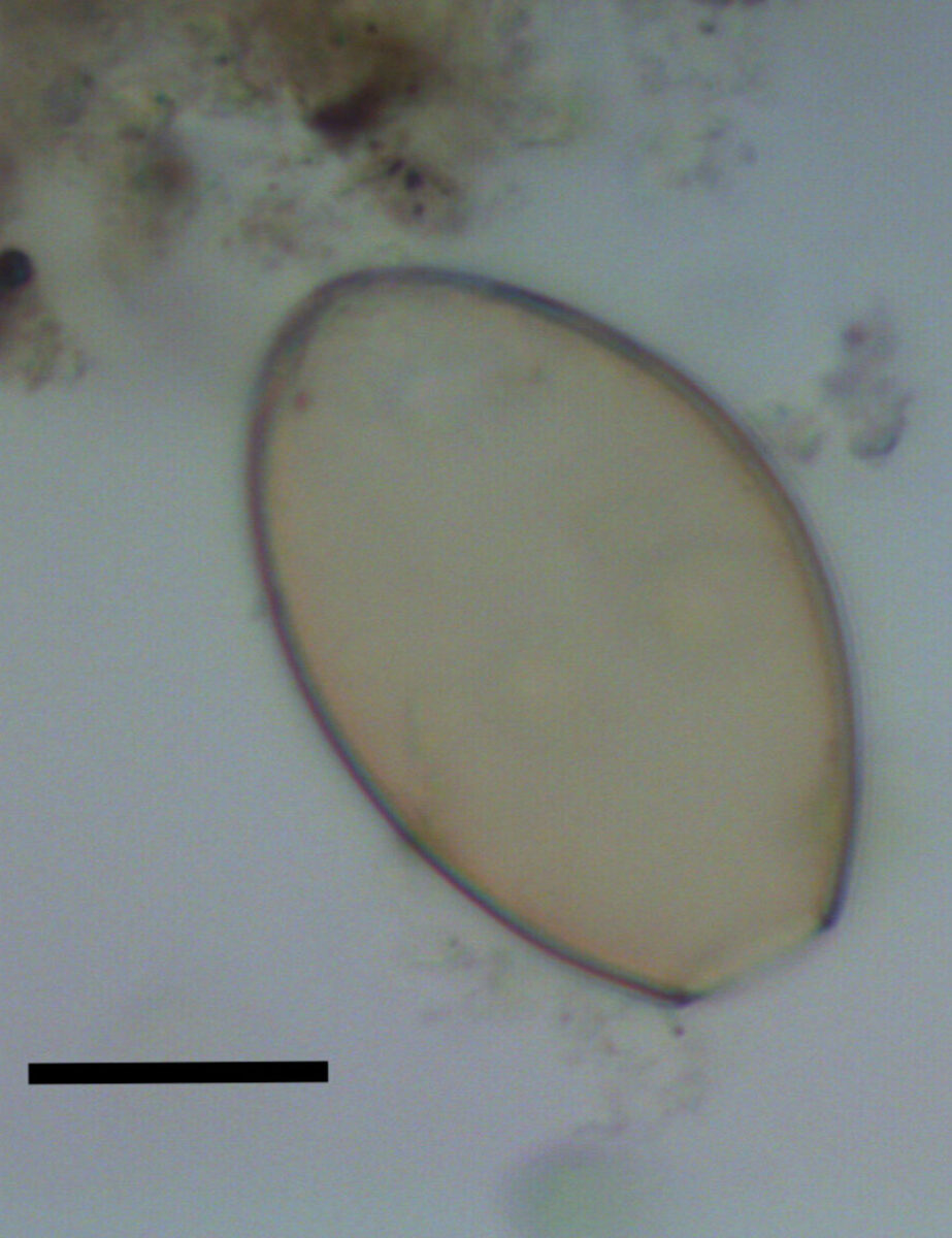 Microscopic egg of fish tapeworm found in dog coprolite. Black scale bar represents 20 micrometres. Credit: Evilena Anastasiou/University of Cambridge