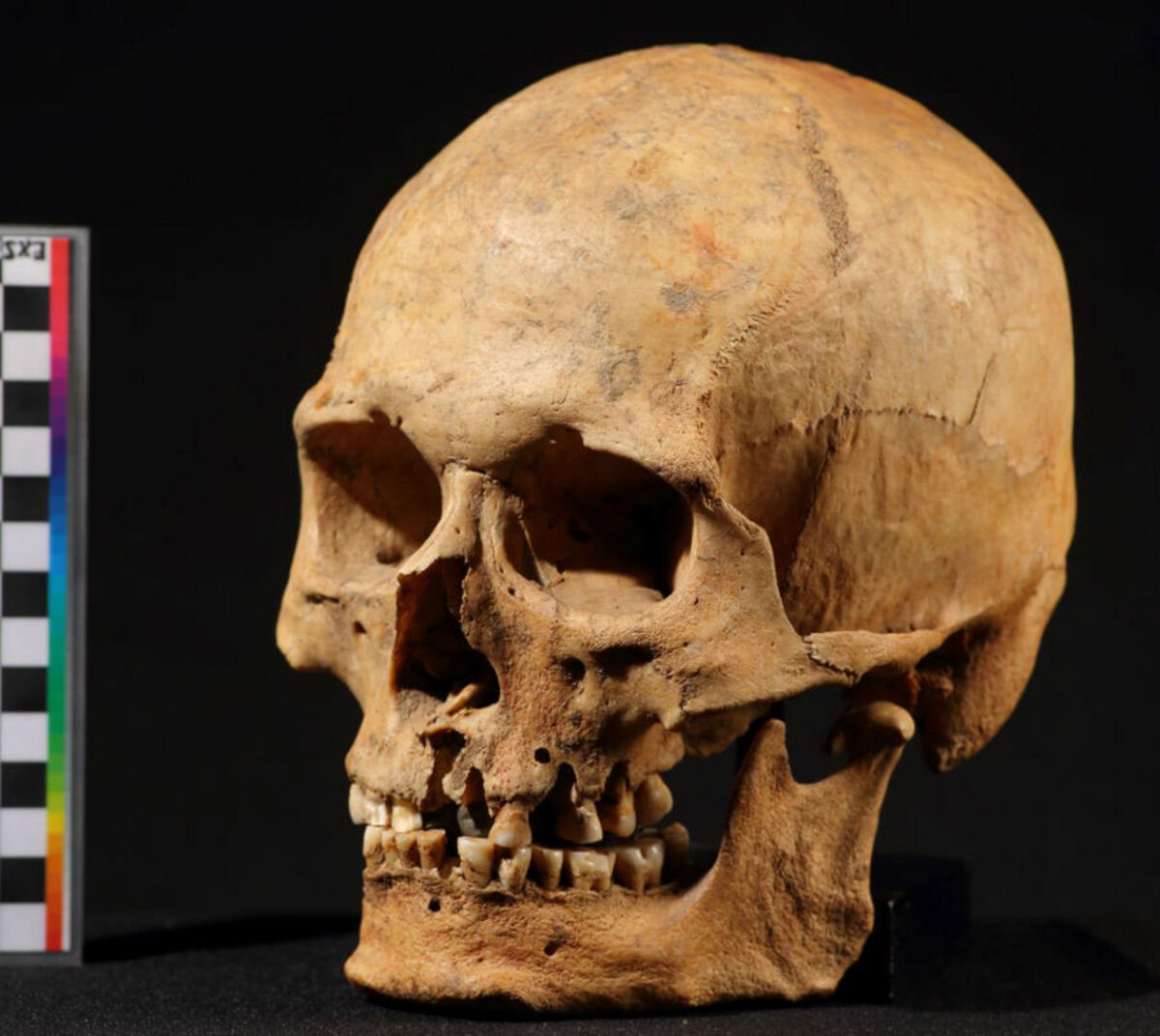 Skull of the Nizhnetytkesken individual. Image credit: Sergey V. Semenov
