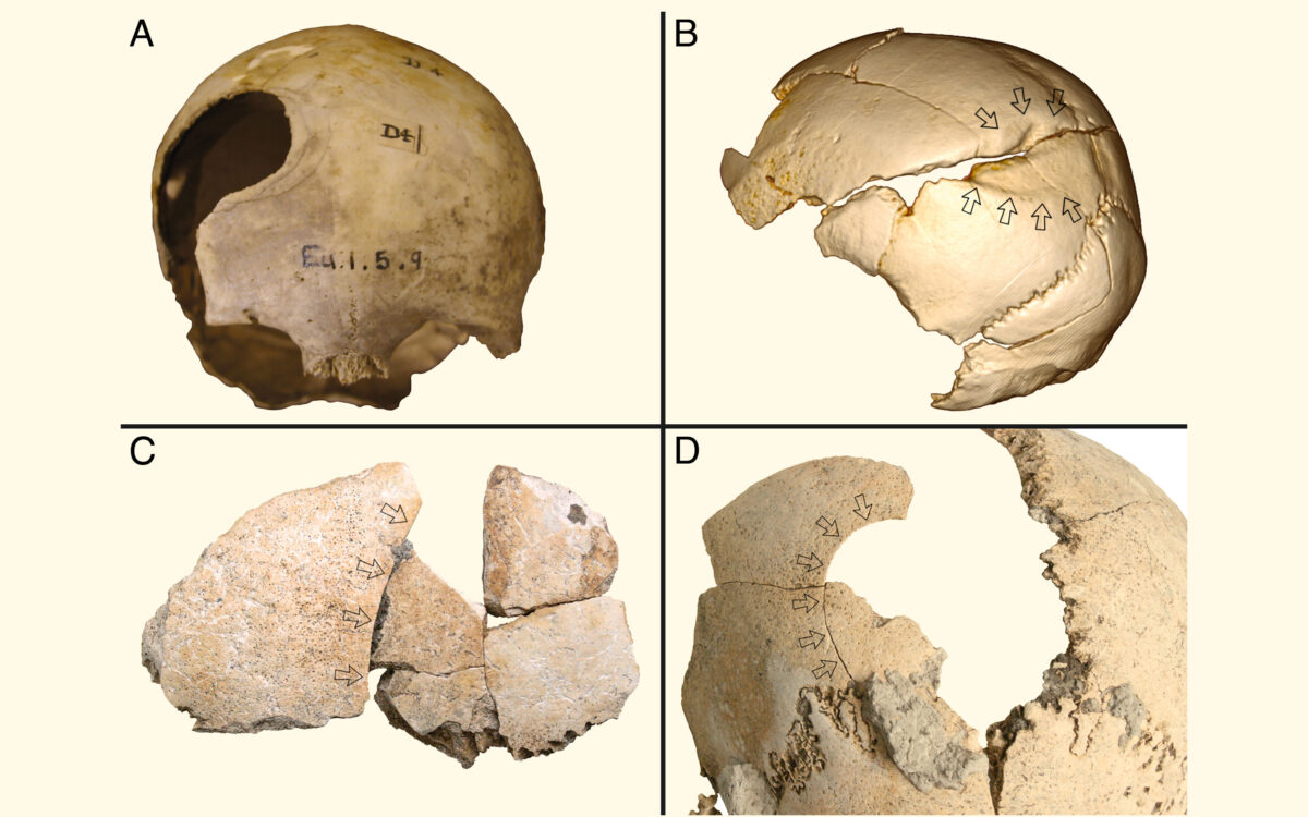Examples of blunt force trauma in Neolithic crania from Northwestern Europe: (A) Belas Knap, England (unhealed); (B) Schöneck-Kilianstädten, Germany (healed); (C and D) Halberstadt, Germany (unhealed). Image credit: L. Fibinger, T. Ahlström, C. Meyer, M. Smith