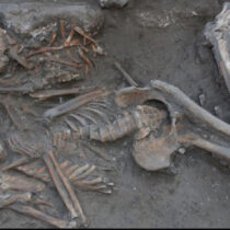 Early evidence of brain surgery in Ancient Near East
