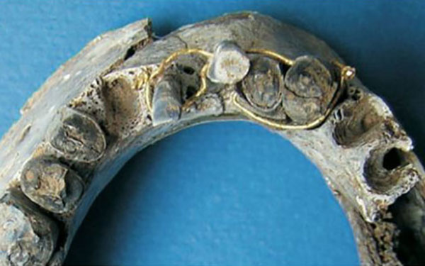 Uncovering the tooth: interventive dental therapy in Ancient Egypt