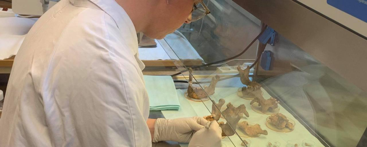 Teeth from individuals among the Viking Age population of Varnhem in Västergötland, Sweden, are clinically examined by Carolina Bertilsson at the Institute of Odontology. Photo: Yoichi Ishizuka