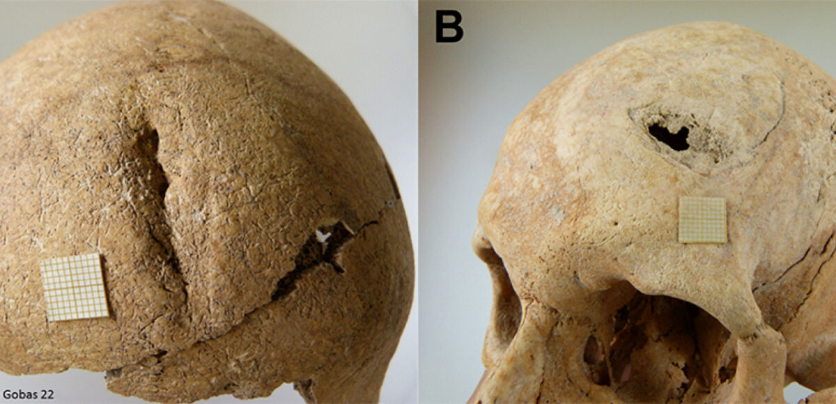Endogamy and pathogens in early medieval Spanish community
