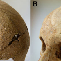 Endogamy and pathogens in early medieval Spanish community