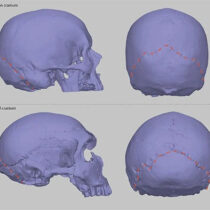 Interbreeding with Neanderthals may be responsible for modern-day brain condition