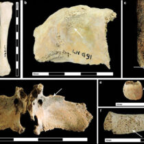 Roman urbanism was bad for Brits’ health