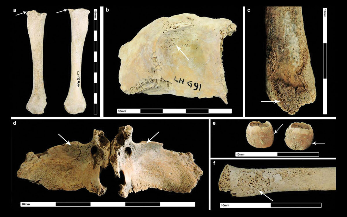 Roman urbanism was bad for Brits’ health