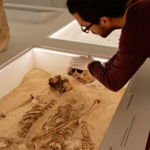 12,000-year-old case of rare genetic disease