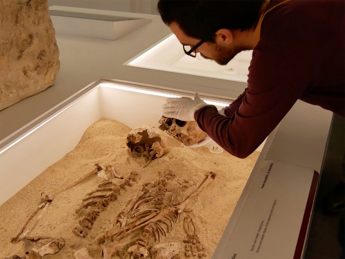 12,000-year-old case of rare genetic disease